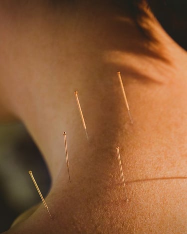 dry needling physical therapy san antonio